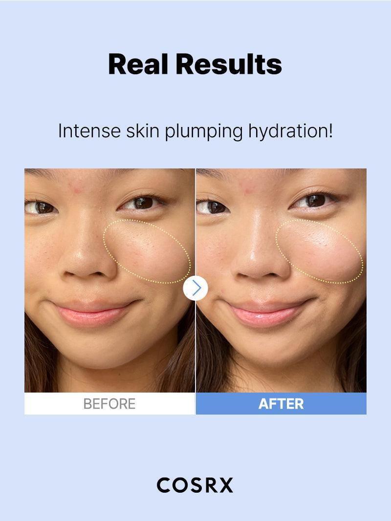 The Hyaluronic Acid 3 Serum 20ml