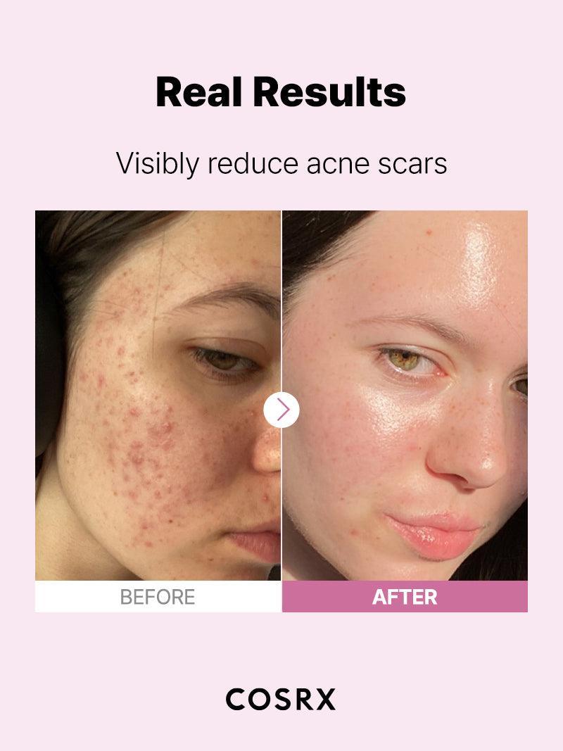 The Niacinamide 15 Serum 20ml